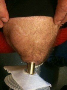 stoma-heesakkers-L-17-mrt-11-225x300.jpg