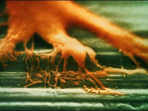 osseointegration-scanning-electron-micrograph1-300x225.png