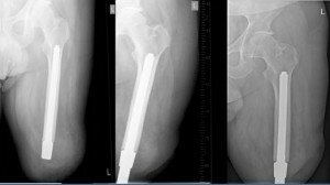 figure4-Copy-300x168.jpg