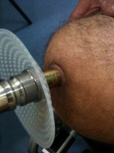 foto fraai stoma
